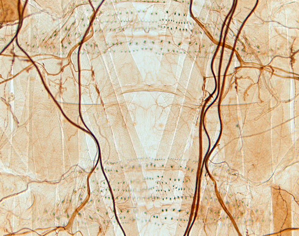 Drosophila Larvae - Tracey Newman